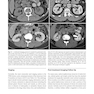 Atlas of Genitourinary Oncological Imaging