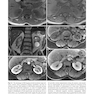 Atlas of Genitourinary Oncological Imaging