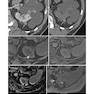 Atlas of Genitourinary Oncological Imaging