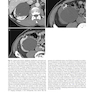 Atlas of Genitourinary Oncological Imaging