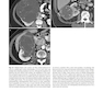 Atlas of Genitourinary Oncological Imaging