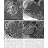 Atlas of Genitourinary Oncological Imaging