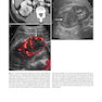 Atlas of Genitourinary Oncological Imaging