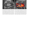 Atlas of Genitourinary Oncological Imaging