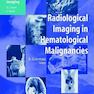 تصویربرداری رادیولوژیک در بدخیمی های هماتولوژیک
