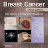 سرطان پستان اولیه