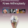 Master Techniques in Orthopedic Surgery: Knee Arthroplasty2019