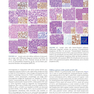 Atlas of Differential Diagnosis in Neoplastic Hematopathology2021