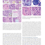 Atlas of Differential Diagnosis in Neoplastic Hematopathology2021