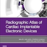 Radiographic Atlas of Cardiac Implantable Electronic Devices2021