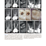 Minimally Invasive Approaches in Endodontic Practice2021