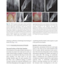 Minimally Invasive Approaches in Endodontic Practice2021