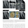 Minimally Invasive Approaches in Endodontic Practice2021