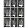 Minimally Invasive Approaches in Endodontic Practice2021