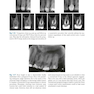 Minimally Invasive Approaches in Endodontic Practice2021