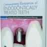 Contemporary Restoration of Endodontically Treated Teeth