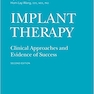 Implant Therapy: Clinical Approaches and Evidence of Success