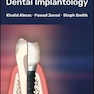 Glossary of Dental Implantology
