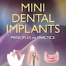 Mini Dental Implants : Principles and Practice