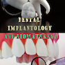 Dental Implantology and Biomaterial