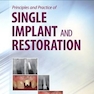 Principles and Practice of Single Implant and Restoration