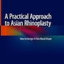 A Practical Approach to Asian Rhinoplasty