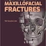 Surgical Management of Maxillofacial Fractures