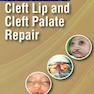 Art and Science of Cleft Lip and Cleft Palate Repair