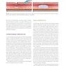 Dermal Fillers for Dental Professionals