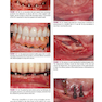 Color Atlas of Dental Implant Surgery 4th Edicion 2015