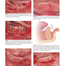 Color Atlas of Dental Implant Surgery 4th Edicion 2015