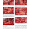 Color Atlas of Dental Implant Surgery 4th Edicion 2015