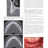 Color Atlas of Dental Implant Surgery 4th Edicion 2015