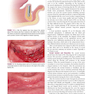 Color Atlas of Dental Implant Surgery 4th Edicion 2015