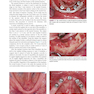 Color Atlas of Dental Implant Surgery 4th Edicion 2015