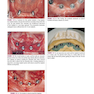 Color Atlas of Dental Implant Surgery 4th Edicion 2015