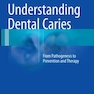 Understanding Dental Caries