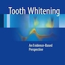 Tooth Whitening