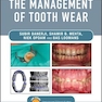 Practical Procedures in the Management of Tooth Wear