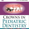 Crowns in Pediatric Dentistry