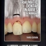 Traumatic Dental Injuries : A Manual