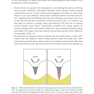 Management of Deep Carious Lesions 2018