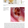 Management of Deep Carious Lesions 2018