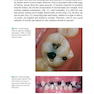 Management of Deep Carious Lesions 2018