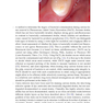 Management of Deep Carious Lesions 2018