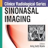 Clinico Radiological Series: Sinonasal Imaging