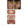 Clinical Cases in Orthodontics 2012