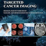 Targeted Cancer Imaging : Design and Synthesis of Nanoplatforms based on Tumor Biology