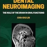 Dental Neuroimaging