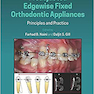 Preadjusted Edgewise Fixed Orthodontic Appliances: Principles and Practice 1st Edicion